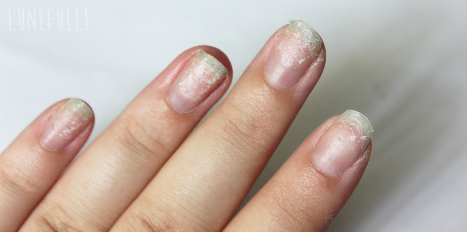 ongles abimés par le gel que faire ongles abimés par le gel que faire